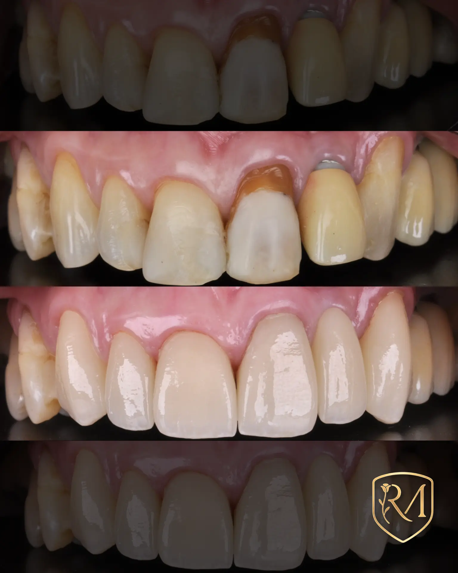 Reabilitação oral funcional e estética